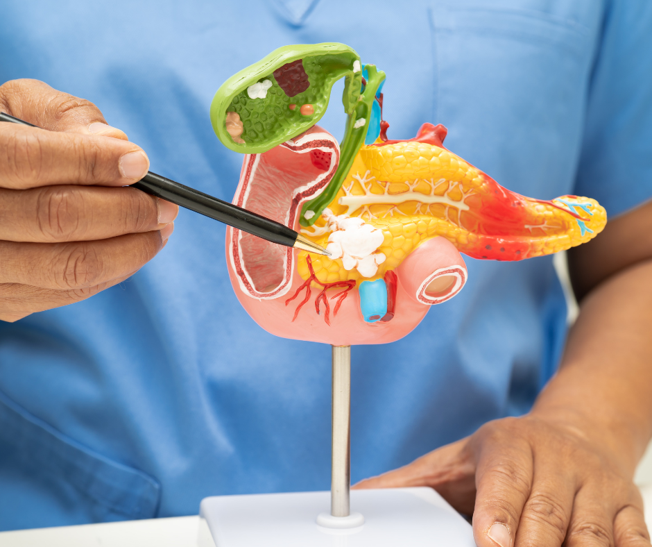 Diet-Induced Inflammation Linked to Fatty Pancreas Risk: An Urgent Wake-Up Call for Better Eating Habits