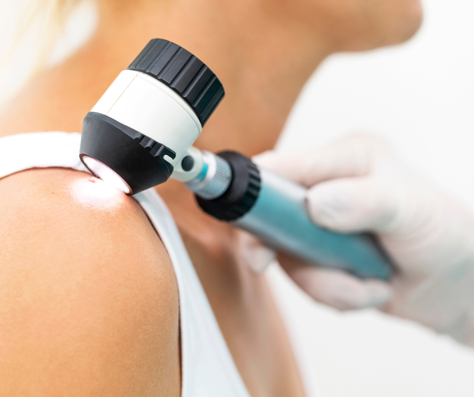 This Group of People Needs Screening for Skin Cancer – Urgently
