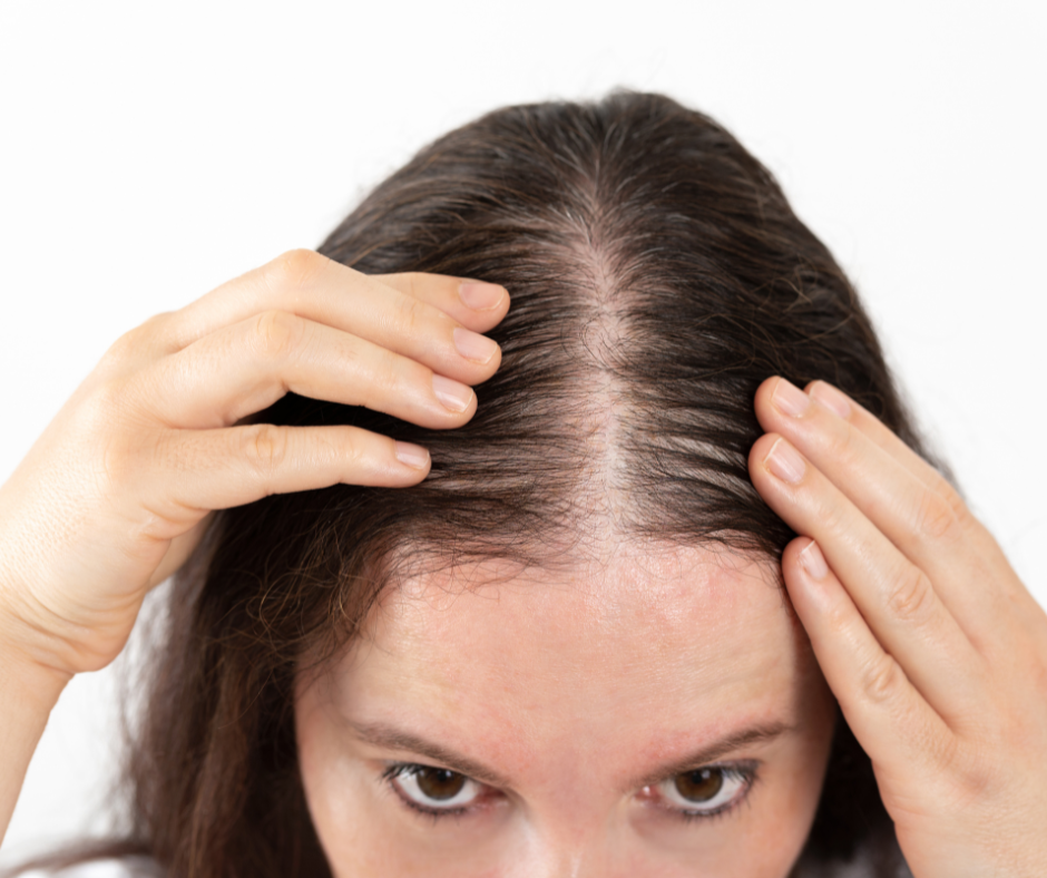 When Your Diet Becomes the Hidden Cause of Hair Loss: The Nutritional Wake-Up Call You Can’t Ignore