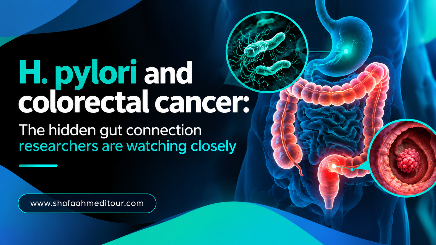 H. pylori and colorectal cancer: The hidden gut connection researchers are watching closely